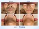 カイ メンズ脱毛アンドネイル(KAI)の写真