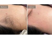 クオーラ(Cuora)の雰囲気（お蜜脱毛で産毛と古い角質をケアしてつるんとなめらかな肌へ）