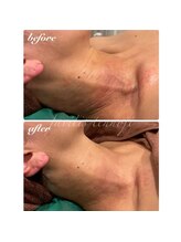 ファビリス 天王寺店(FAVILIS)/ハーブ3ｇ1回/40代