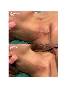 ファビリス 天王寺店(FAVILIS)/ハーブ3g1回/40代