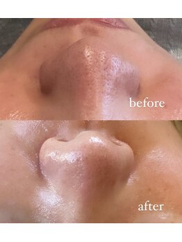 チアリス(chiariss)/富山市/まつげパーマ/眉毛