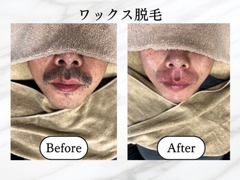 エスポワール(Espoir)/ワックス脱毛で即日ツルツル♪