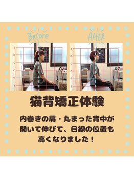 あんどら鍼灸接骨院/猫背矯正