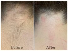 ノンノン(NonNon)/うなじ見られてますよ！