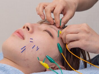 いとしまリハキュア整骨院の写真/お顔の様々なお悩みに◎小顔効果絶大★短期間で効果を感じたい方に◎