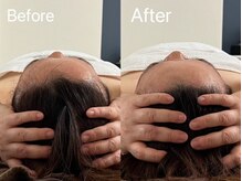 ベルフェム(Bellefemme)の雰囲気(頭蓋骨、噛み合わせ、美輪郭、美小顔で痛み目の疲れ頭痛スッキリ)