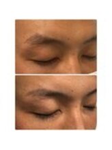 アイビー 神保町店(i.b)/眉【before⇒after】７