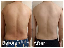 スマイルボディ つぼの森 加治木店(Smile body)/痩身☆デトックスマッサージ