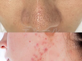 デジール/【メンズ】初心者も始めやすい♪