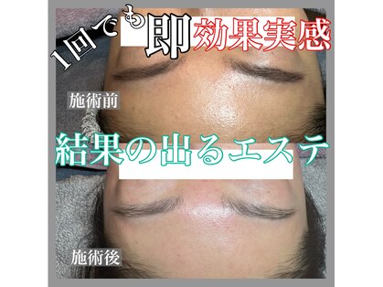 ディンプル(Dimple)の写真
