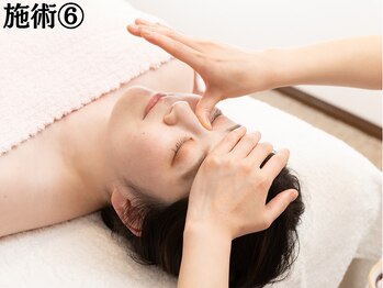 ラプリ 大宮店(Raplit)/施術6 鼻の矯正 鼻筋/曲がり矯正