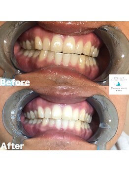 プラチナムビューティー 横須賀店/