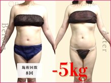 痩身エステ 美容整体 ドクタースタイル(Dr.Style)/最新痩身マシン&リンパ/岐阜
