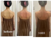 ロココ 横浜店(Rococo)/痛みに弱い方必見！