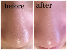 サロンドリマ(Salon de Lima)/ララピール正規取扱店！韓国肌