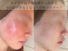 ポアレ(POARE)の雰囲気(1年でコンシーラーいらず!厚塗り卒業隠さないメイクで毎日happy)