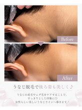 フェリーチェ 大塚店(Felice)/うなじ脱毛で美しい後ろ姿へ♪