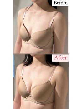 ラビス(RAVIS)/産後のバストもケアで復活！