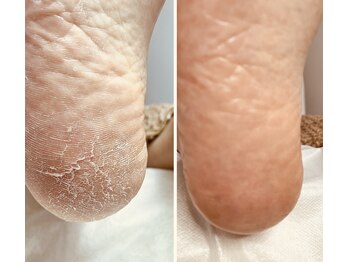 ラヴィ(La vie)/急な乾燥から一気に…