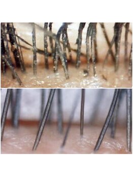 ビューティーアイラッシュ 豊橋カルミア店/アイシャンプー