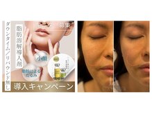 ラ ムールの雰囲気（レモンボトルでたるみ改善しフェイスラインスッキリ、小顔効果に）