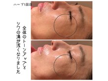 エンザイム スパ(enzyme spa)の雰囲気（大人のお悩みに特化したフェイシャル多数メニューあります）