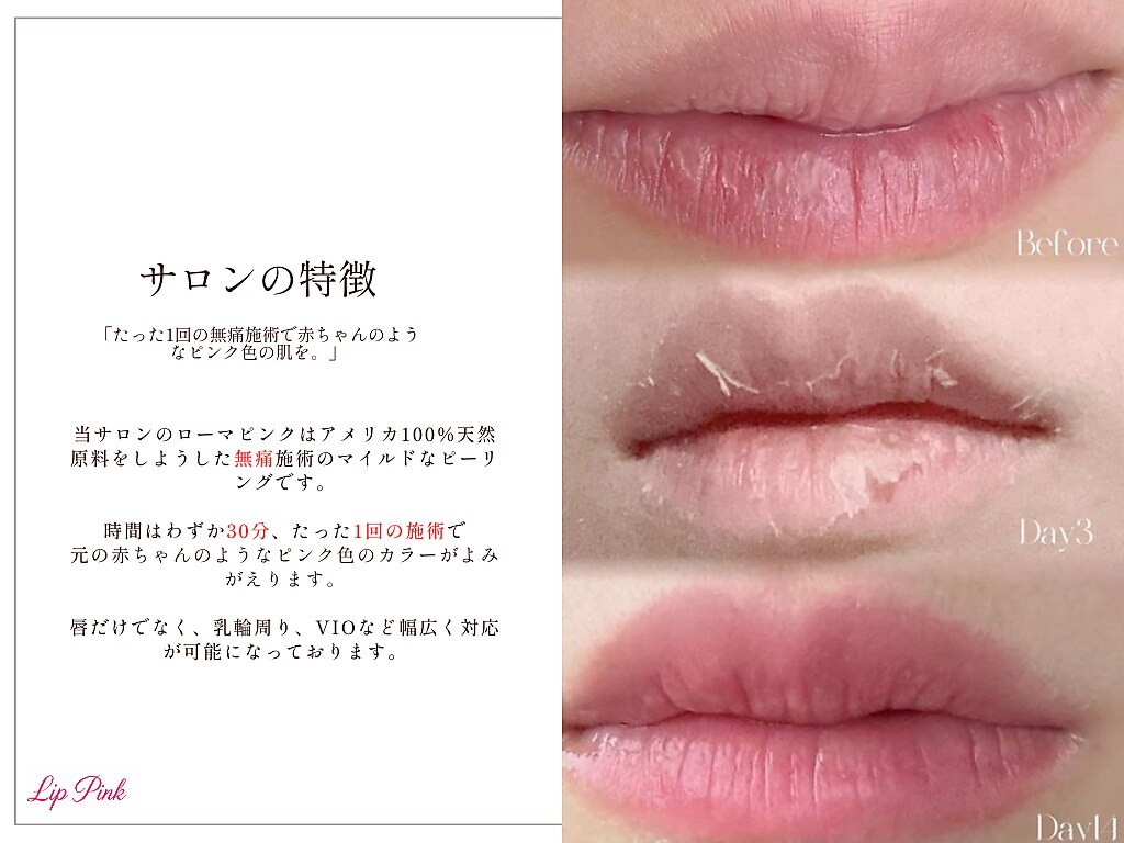 リップピンク 武蔵小杉店(lip pink)｜ホットペッパービューティー