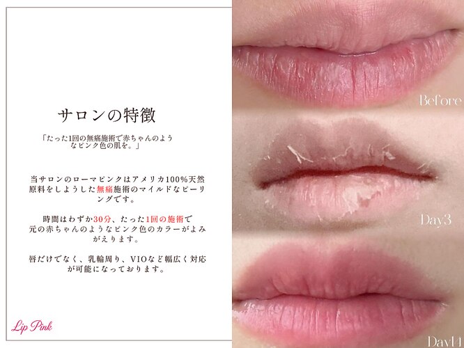 リップピンク 武蔵小杉店(lip pink)｜ホットペッパービューティー