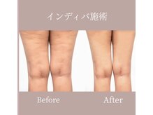 カノン(Kanon.)/インディバボディ