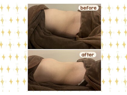 アネクル(ANECUL)の写真