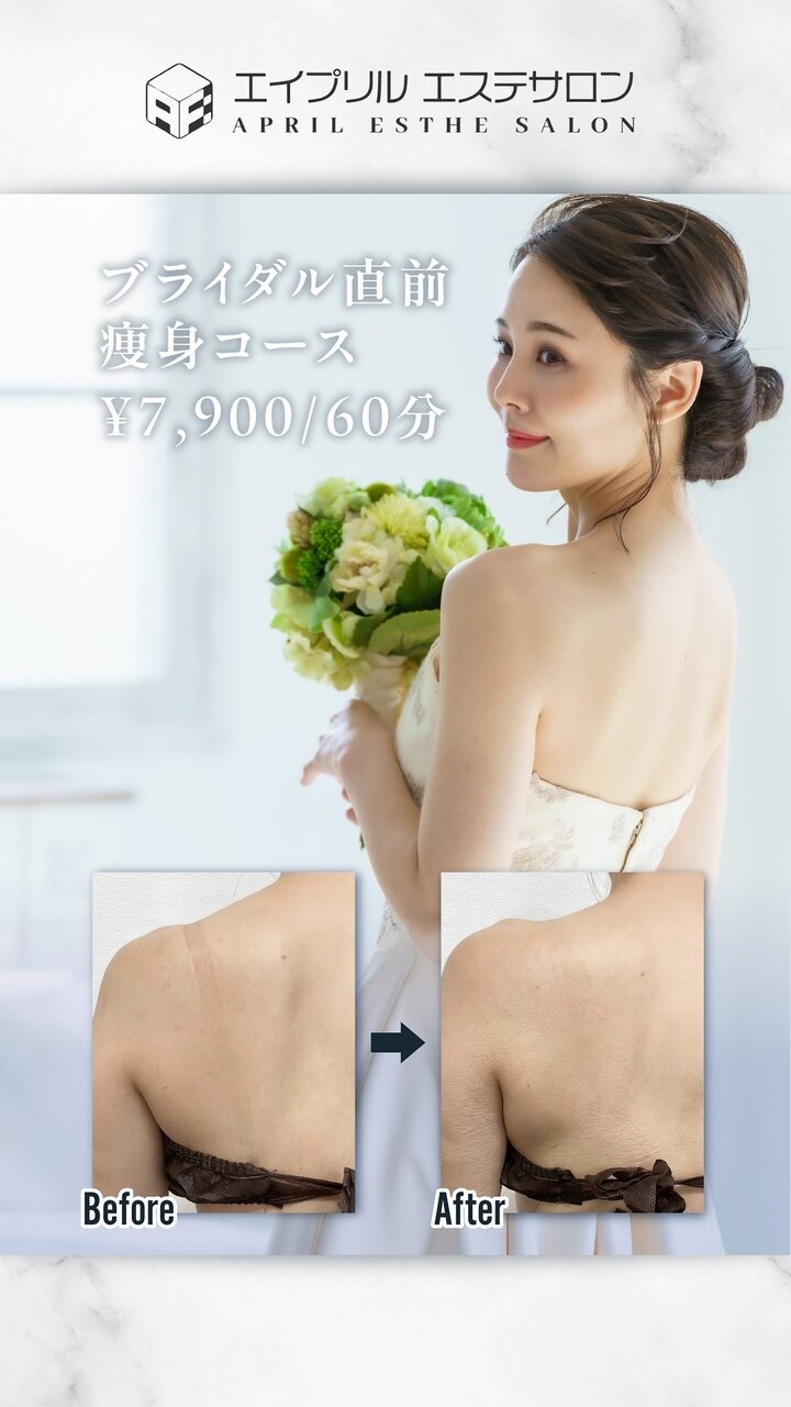 【ブライダル直前部分集中ケア】背中・二の腕スッキリ♪60分集中コース