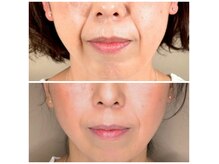 スパ アールアンドビー(SPA*R&B)の雰囲気（いつまでも綺麗でいたい★小顔×BBL照射トータルエイジングケア）