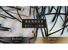ヘッドサイエンス(HEADSCIENCE)の雰囲気（頭皮状態を把握し、専用機械で頭皮環境を改善へ導きます。）