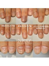 ニコプラス(NICO+)/自爪育成パラジェルクリア補強