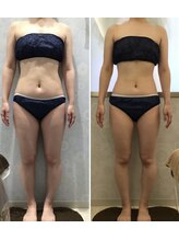 チャマ 高知店(CHAMA)/全身ケアしたい方