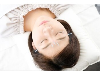 みんなのてもみ 神田駅北口店/健康美容鍼コース