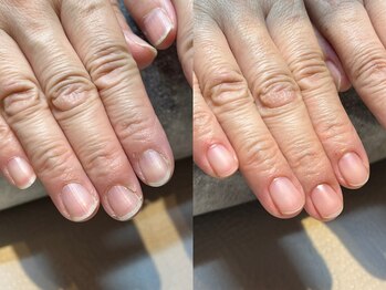 ハンドケア・ネイルケア