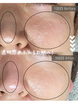 ザ プレザント 大倉山(the pleasant)/クリスティーナのビオフィート