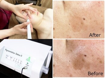 ハクミー(haku me)