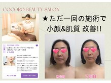 ココロ エステサロン(COCORO)