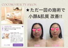 ココロ エステサロン(COCORO)