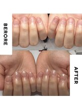 リミズネイルビューティー 名駅店(RimisNailxbeauty)/【美爪育成】深爪・噛み爪改善