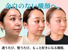 ナチュラルパーフェクトフェイス 新宿