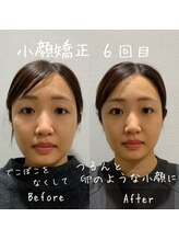 ニコ(NICO)/お客さまのビフォーアフター