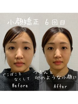 ニコ(NICO)/お客さまのビフォーアフター