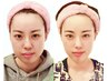 人気イチオシ【小顔美肌コルギ】小顔美肌コルギ/美肌/通常14400⇒9900コルギ