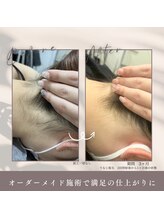 モアトゥインクル 福山宮通り店(MORE twinkle)/脱毛してうなじ美人