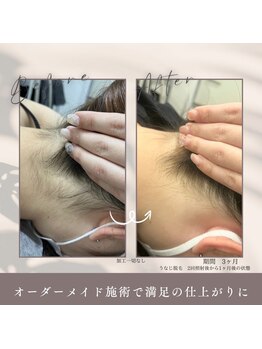モアトゥインクル 福山宮通り店(MORE twinkle)/脱毛してうなじ美人