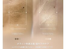 エンジェルラッシュ(Angel lash)の雰囲気（メラニンピンクケアもやってます！お問い合わせは@xie8207l ）