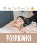 【平日限定Instagramフォロー&いいね割】お顔お試し美容鍼 90分 ￥3600